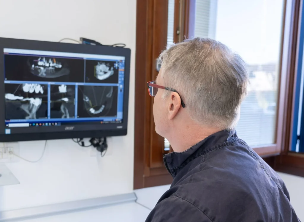 Quanto dura un impianto dentale? 1 quanto dura un impianto dentale