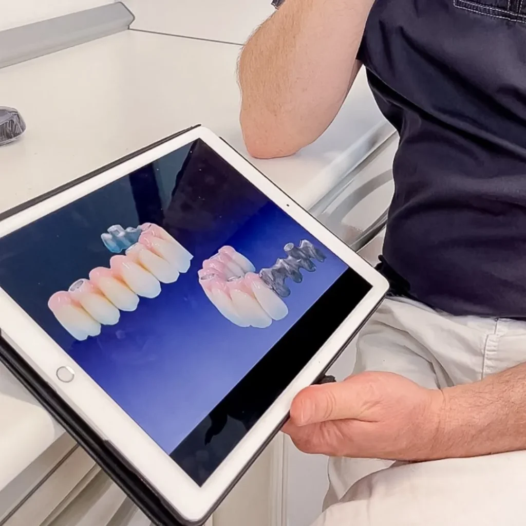 Protesi 1 PROTESI FISSA E MOBILE - dentiera a Castelfranco Veneto