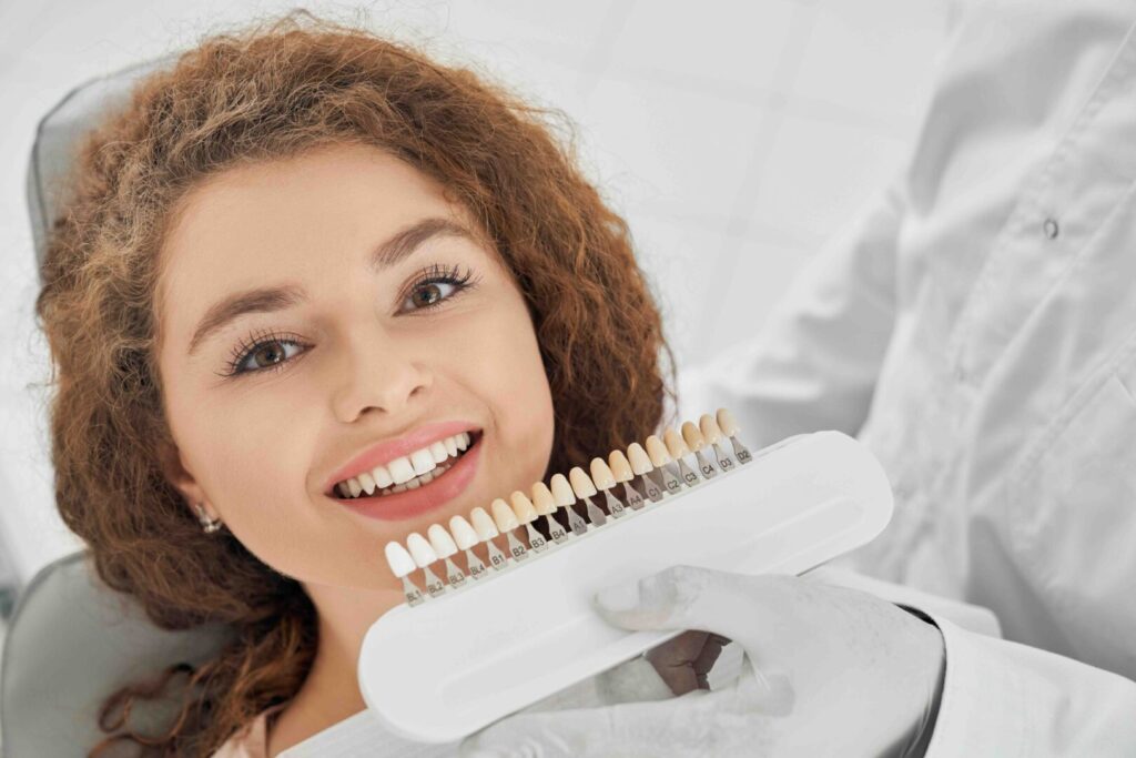 Faccette dentali come funzionano 1 Cosa sono le faccette dentali