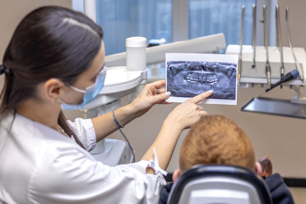 Spiegazione chiara di un impianto dentale: cos'è, come funziona e quando sceglierlo 2 spiegazione chiara di un impianto dentalev